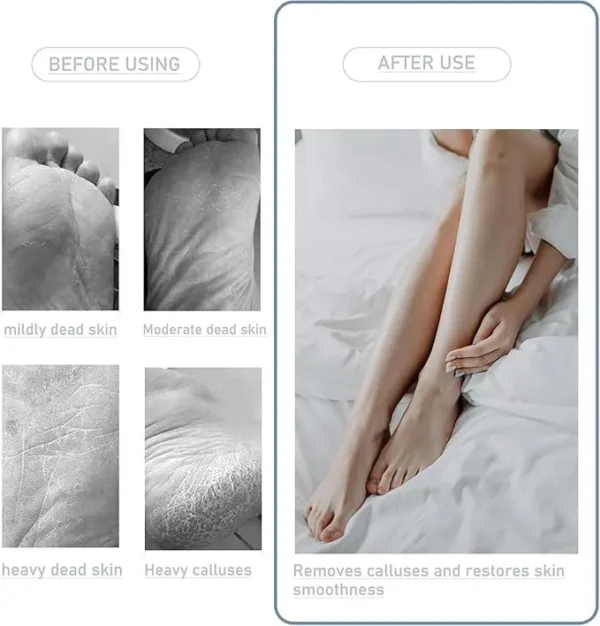 Foot Toe Cleaning Brush – Soft Bristle Scrubber for Feet, Toes & Nails | Shower Foot Cleaner for Dead Skin Removal, Exfoliating & Massage